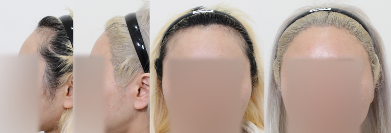 포토후기 이미지