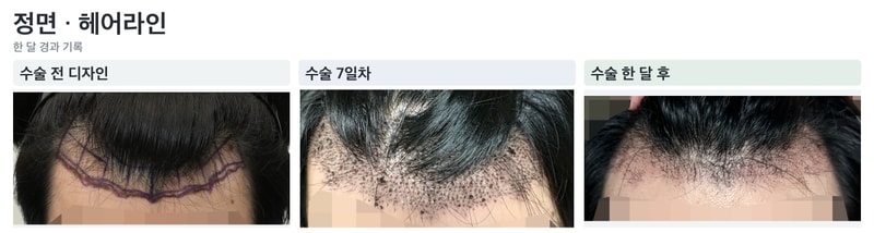 포토후기 이미지