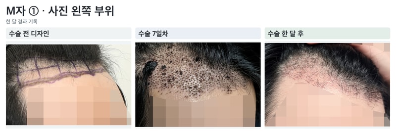02_M자_사진왼쪽.jpg