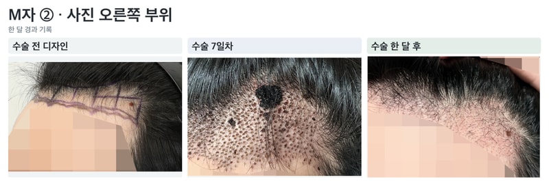 03_M자_사진오른쪽.jpg