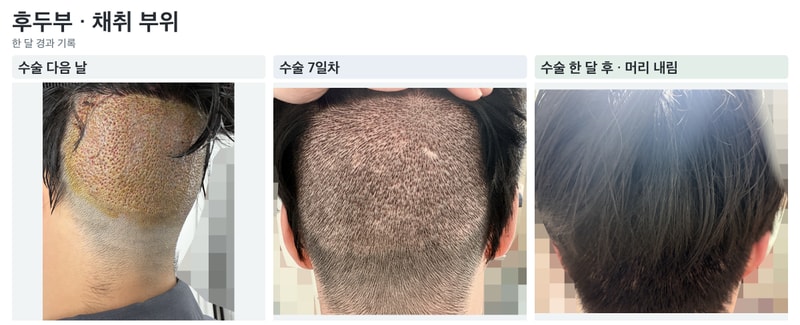 04_후두부.jpg