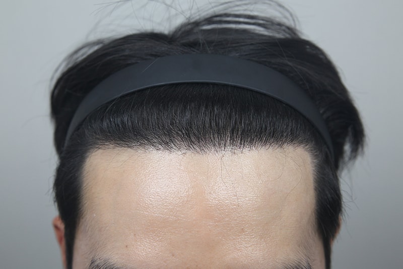 포토후기 이미지