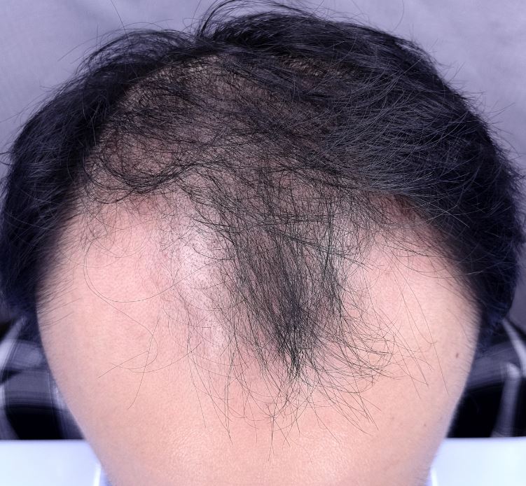 포토후기 이미지
