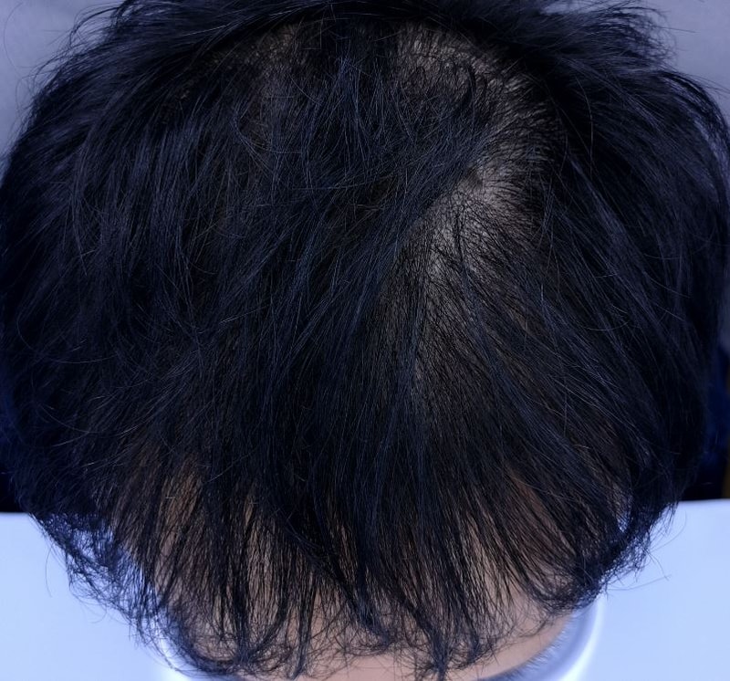 백설빈 4500 1y.JPG