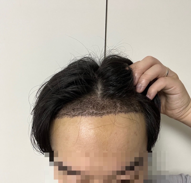 output_995791460.jpg