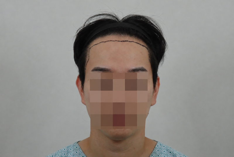 임상 스타일 픽셀 모자이크 초상화.png