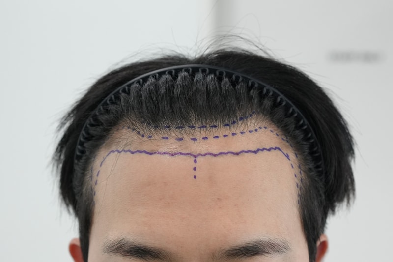 수술디자인.jpg