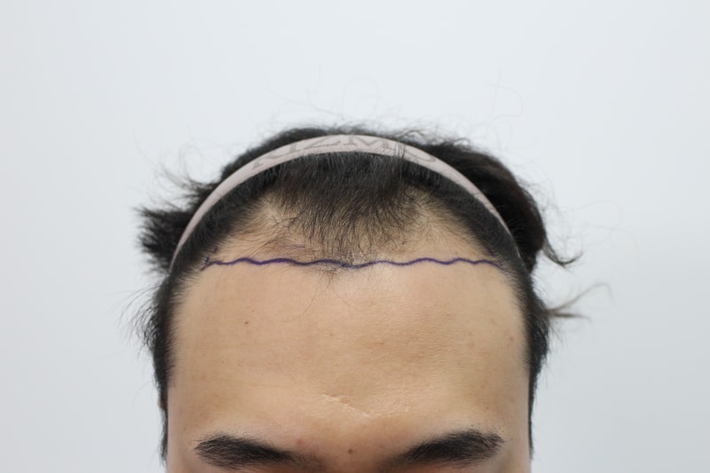 1000046442.jpg