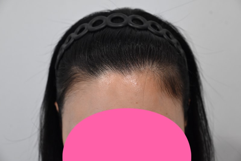포토후기 이미지