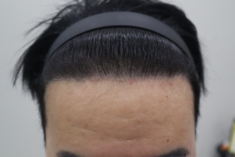 1년경과 (4).png