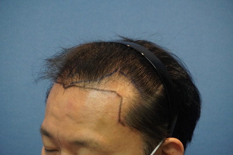수술전_3.jpg