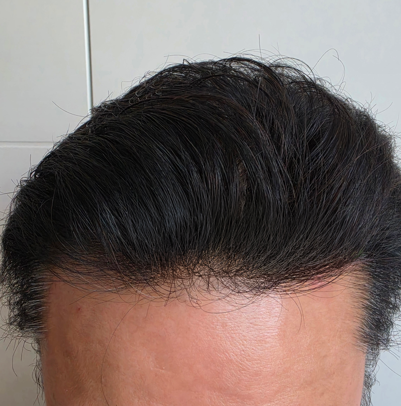 수술후_3.png