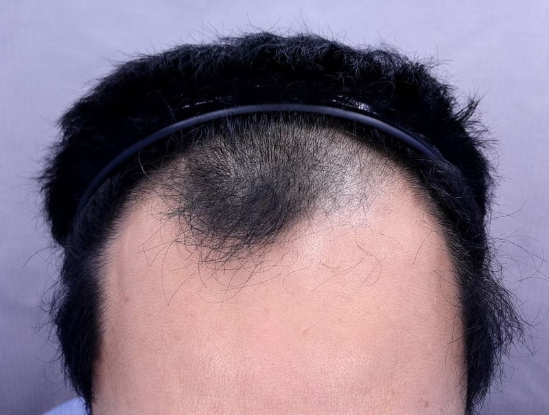 포토후기 이미지