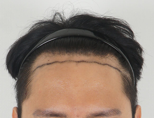 포토후기 이미지