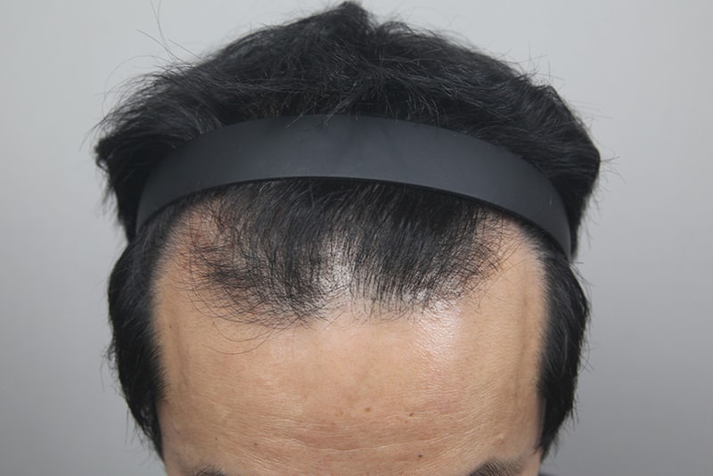 포토후기 이미지