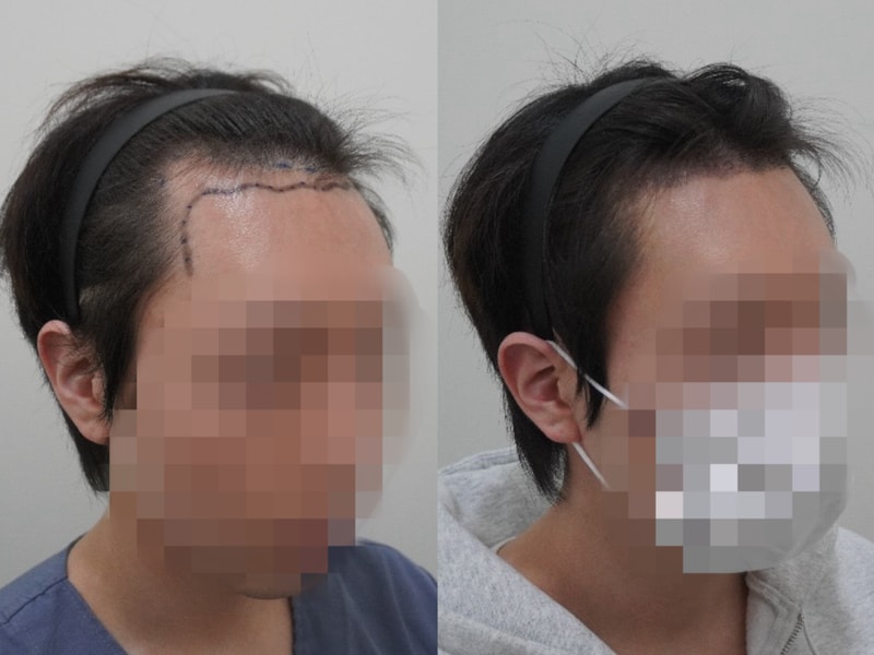 포토후기 이미지