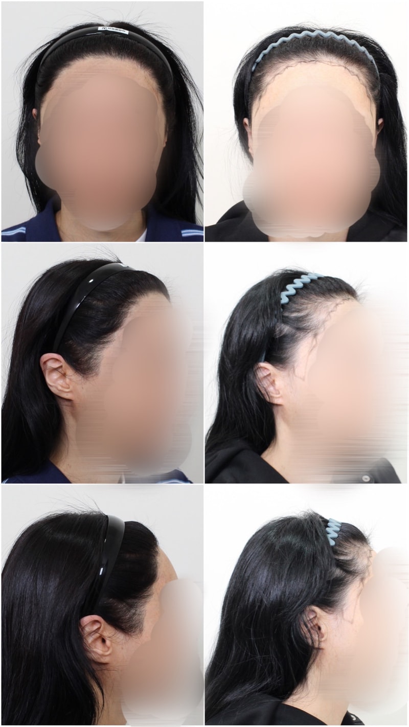 포토후기 이미지