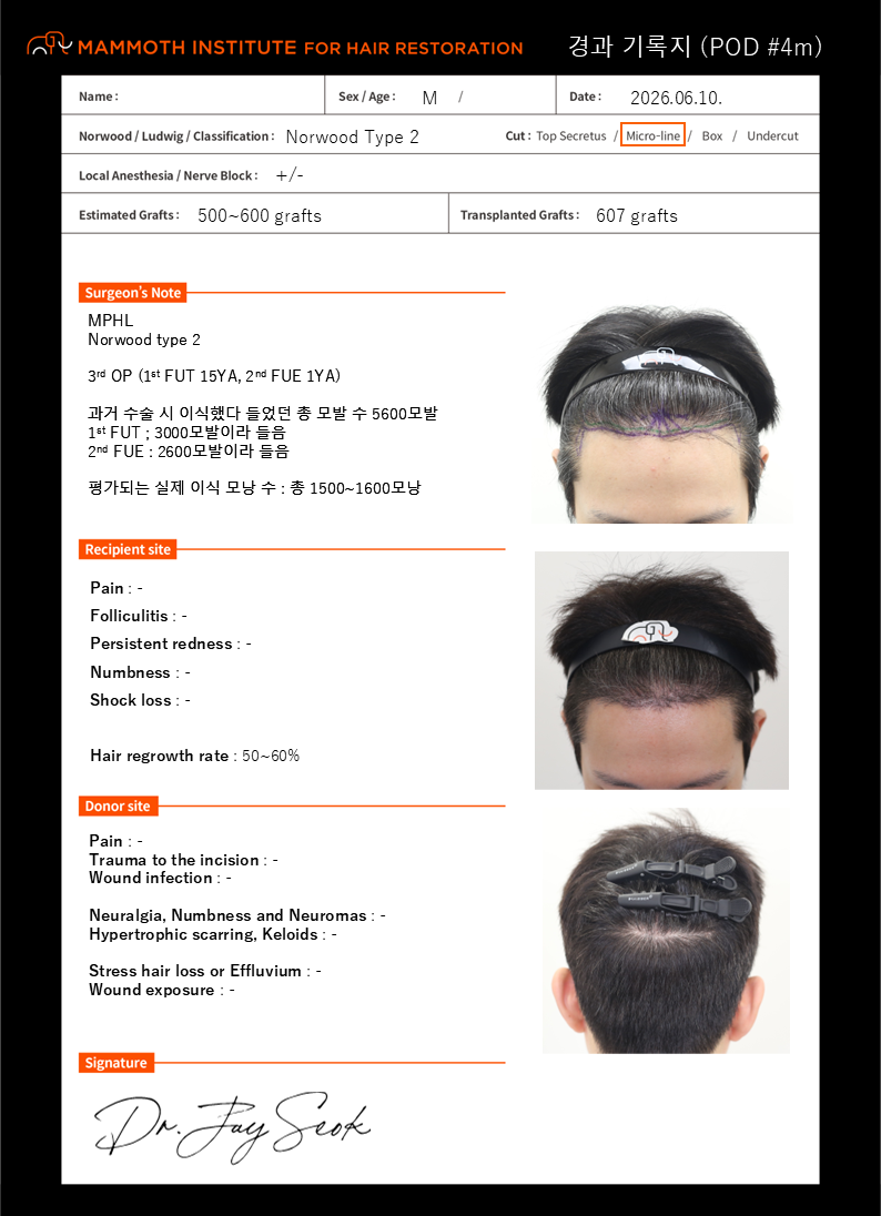 포토후기 이미지
