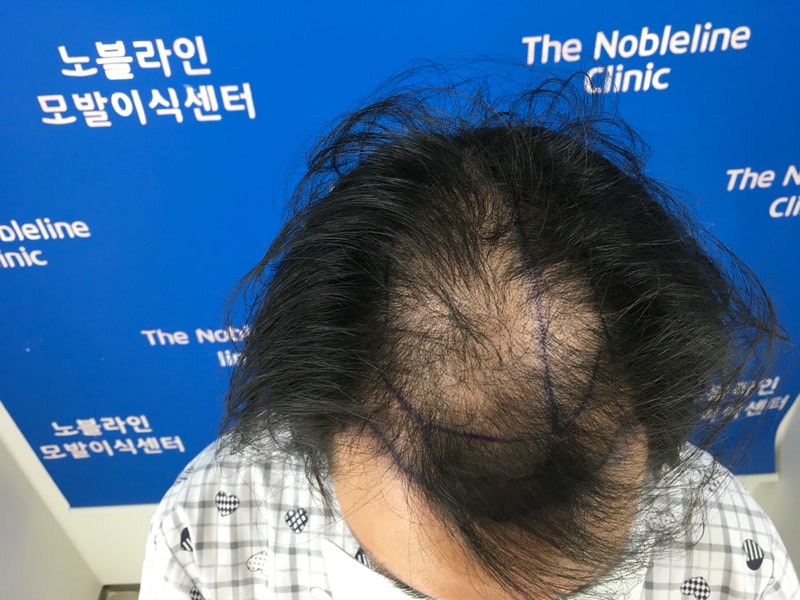 포토후기 이미지