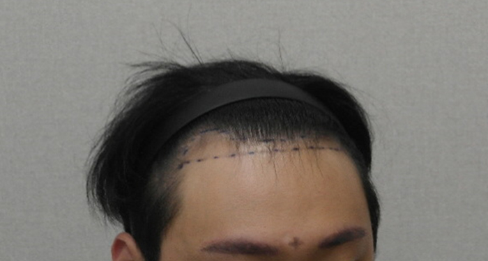 디자인후2.JPG