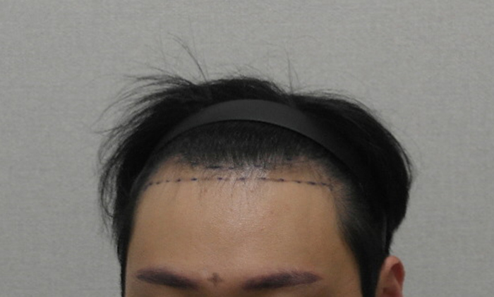 디자인후3.JPG
