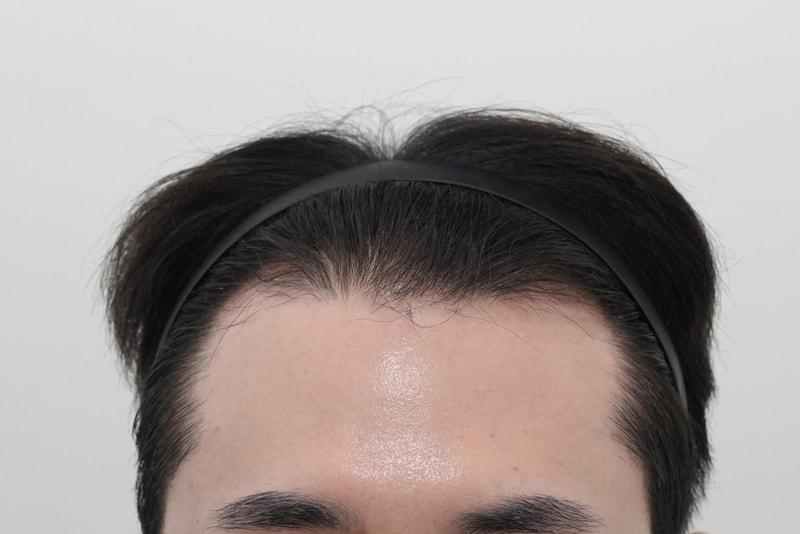 수술전.jpg