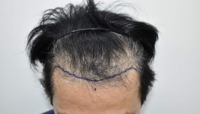 포토후기 이미지