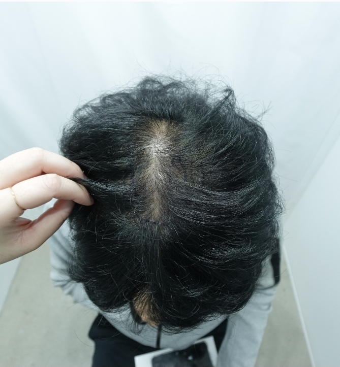 포토후기 이미지