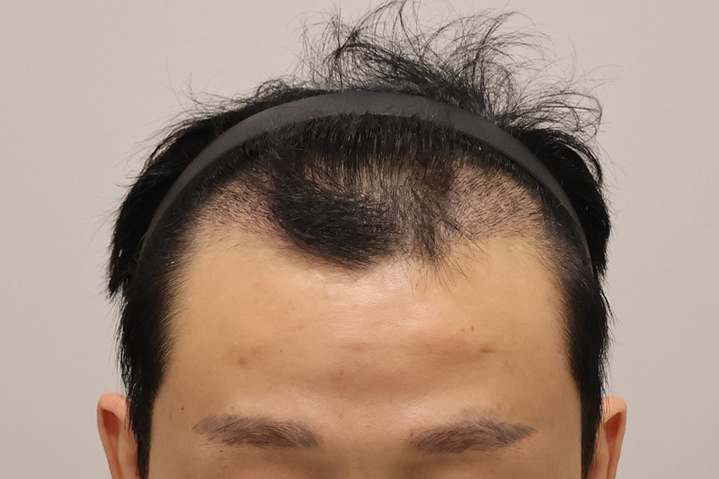 4.png