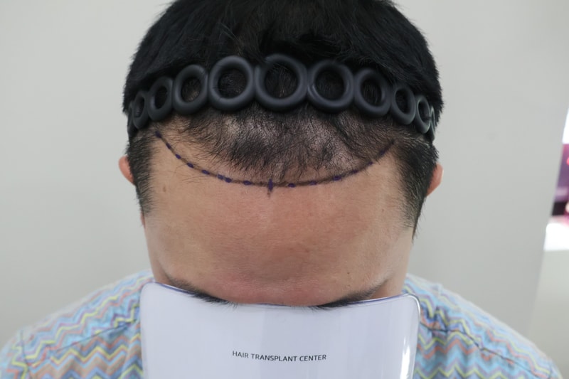포토후기 이미지