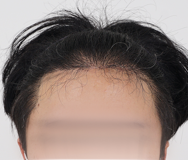 포토후기 이미지