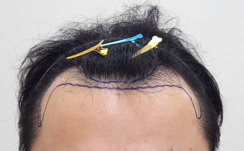 포토후기 이미지