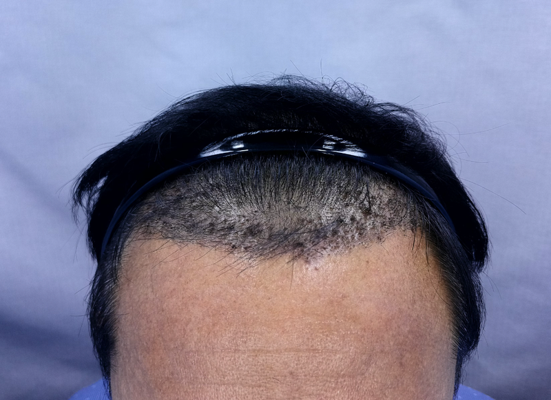 황하 m.mid 3000 2주 (5).png