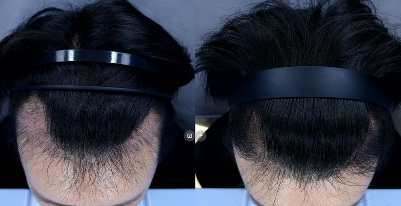 3개월-6개월.png