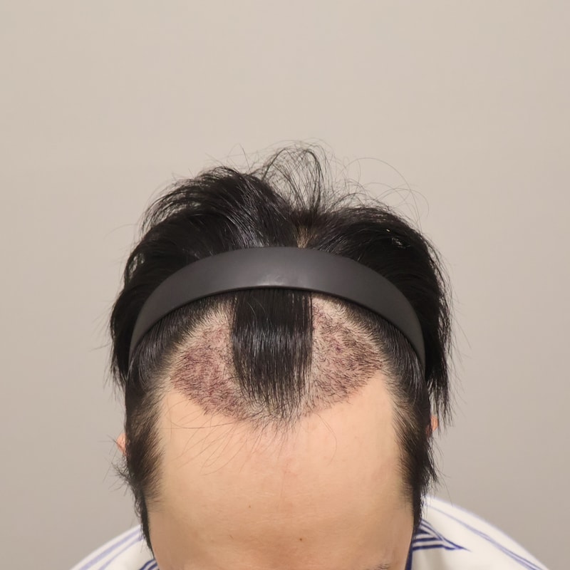 포토후기 이미지