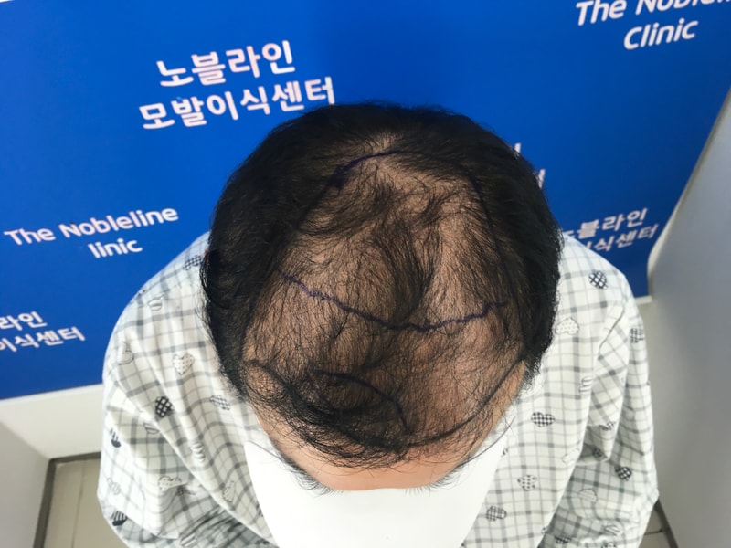 포토후기 이미지