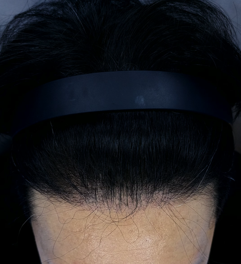 9mo.png