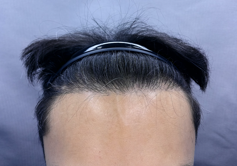조선행 h.l 2700 9mo (2).png