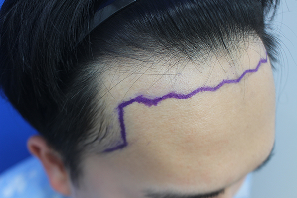 2.JPG