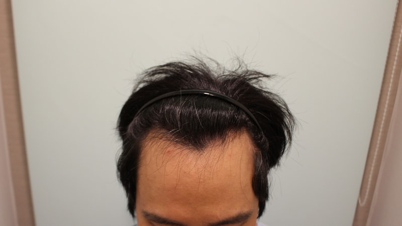 수술전2.jpg