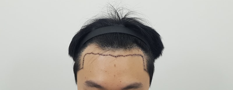 포토후기 이미지