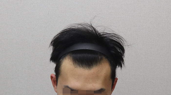 포토후기 이미지