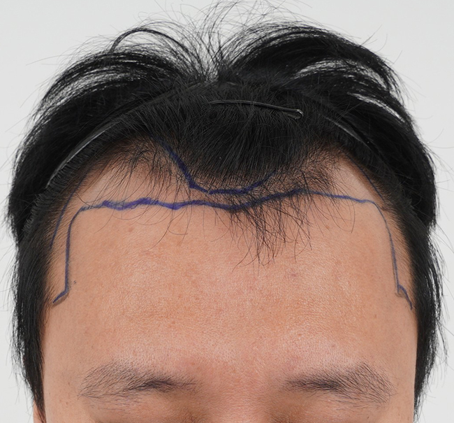 포토후기 이미지