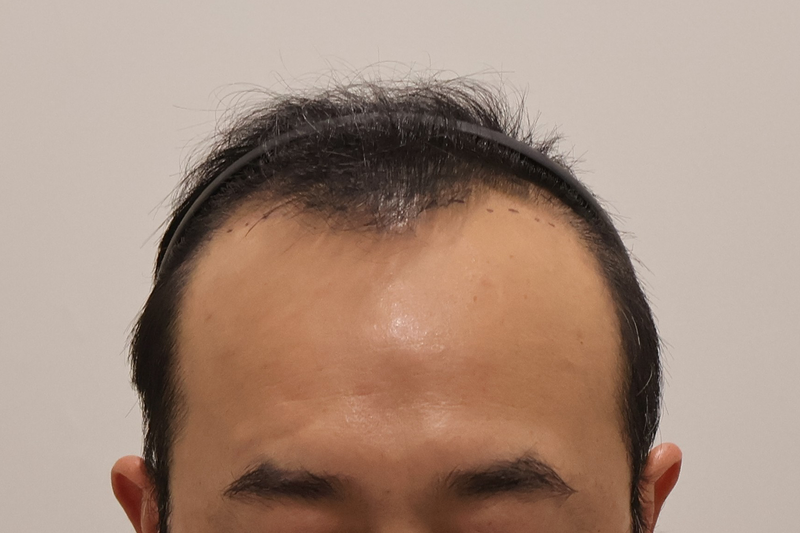 포토후기 이미지