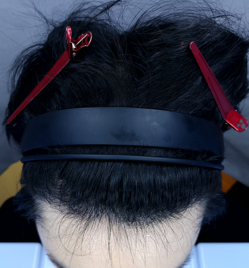 9mo .png