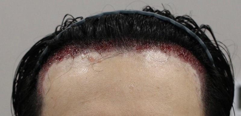IMG_2845.jpeg