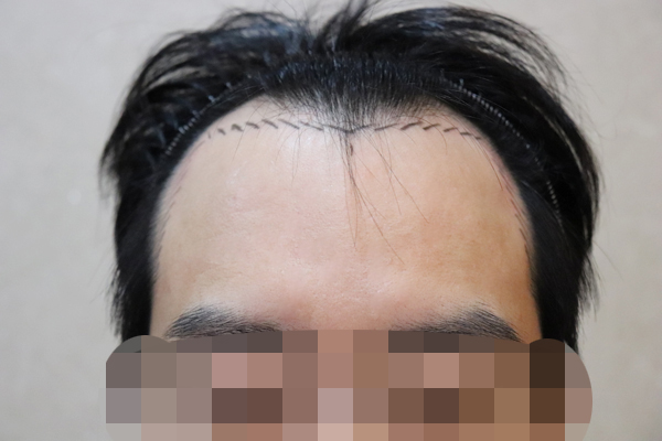 포토후기 이미지