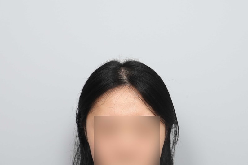 포토후기 이미지