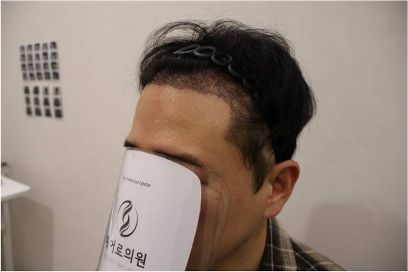 2주후 1.jpg