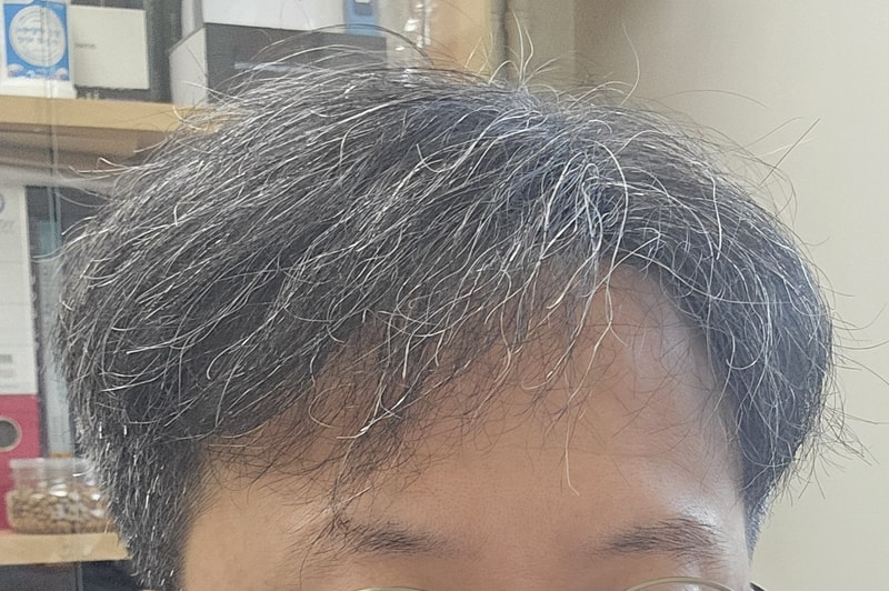 1년차_좌.jpg